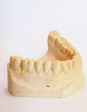 牙科印模3