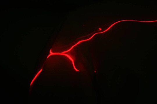 心電圖