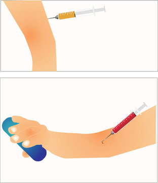 針頭和注射器的不同用法