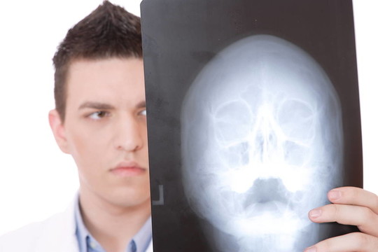 白人中年男醫(yī)生拿著X光。