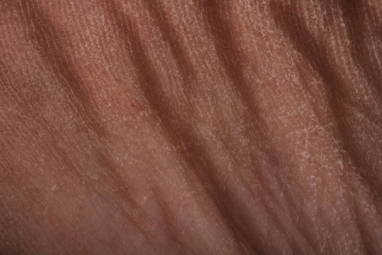 人體皮膚褶皺的質(zhì)地