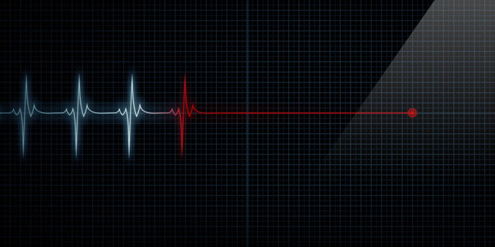 心臟監(jiān)測單位線死亡