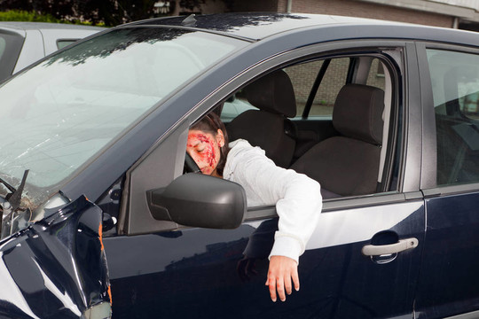 車禍中流血的受害者