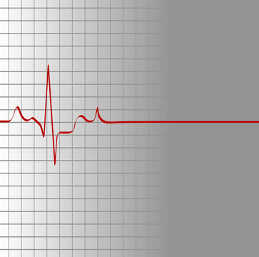 隨著心臟的跳動(dòng)網(wǎng)格然后死亡