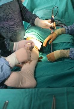 外科手術(shù)