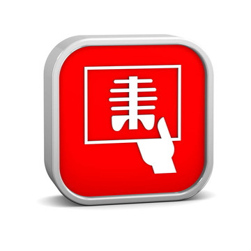 X線(xiàn)征象