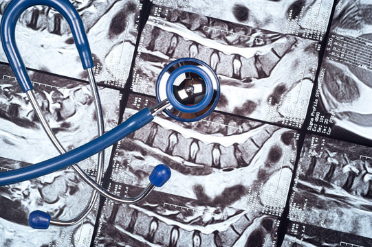 Stethosope在MRI