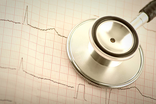 醫(yī)用聽診器和心電圖（ECG；EKG）部分特寫