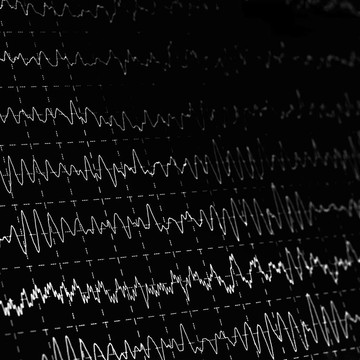 腦電波encephalogramme腦電圖