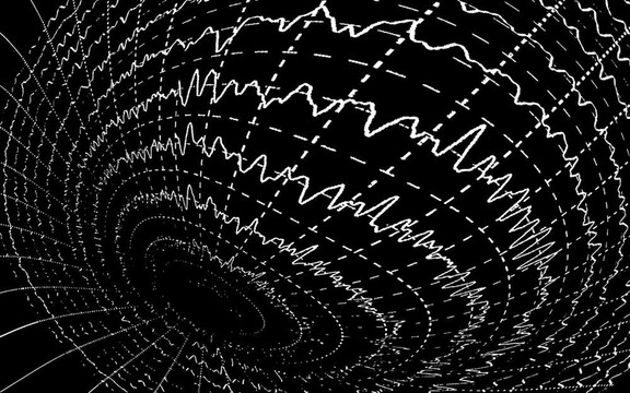 在encephalogramme EEG腦電波