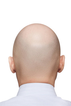 禿頭的男人的頭