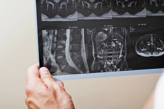 MRI