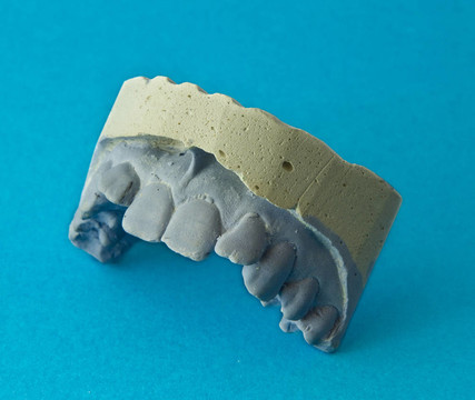 牙齒石膏模型