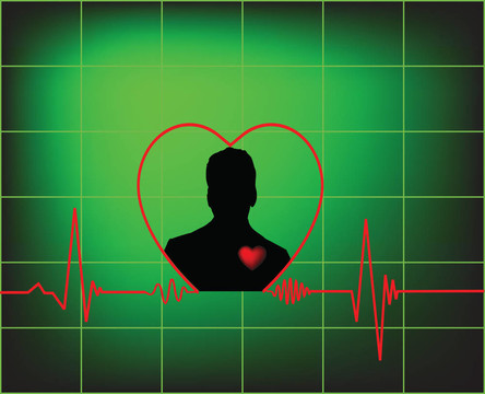 心cardiogramme