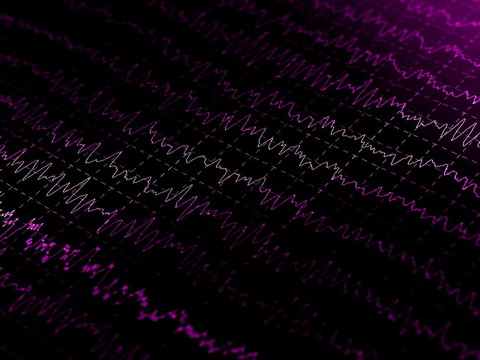 腦電波（EEG）