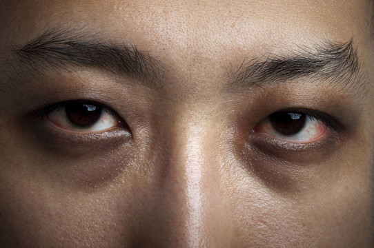 失眠癥