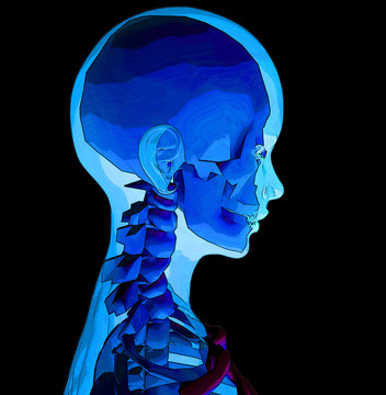 X Ray 4