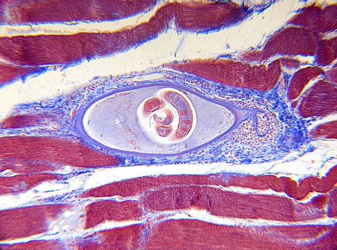 顯微鏡下的Trichinella spiralis