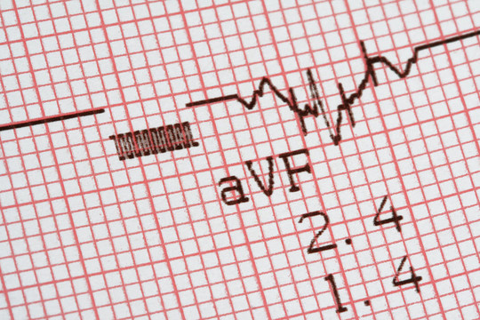 cardiographical測試結果