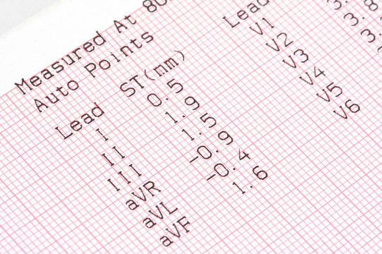 cardiographical測試結(jié)果