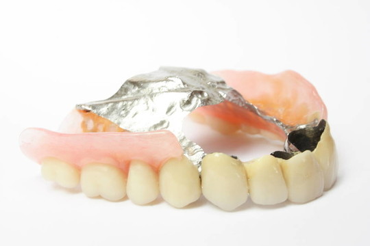 牙科修复体；义齿瓷