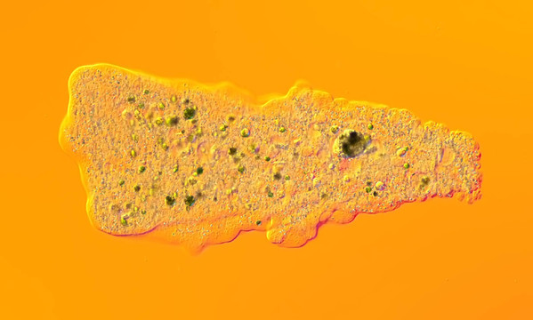 變形蟲（dinamoeba carolinensis）