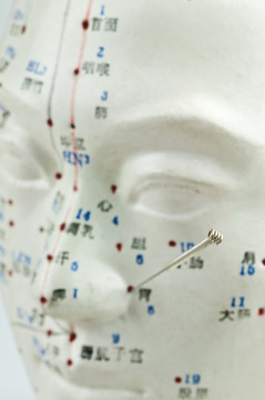 針灸針
