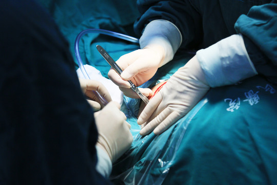 剖腹產
