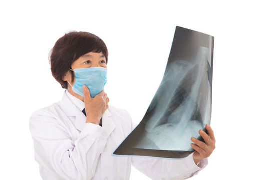 女醫(yī)生在認(rèn)真的查看肺部X光片