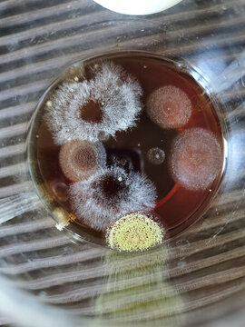 霉菌