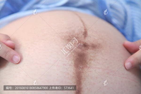 孕婦