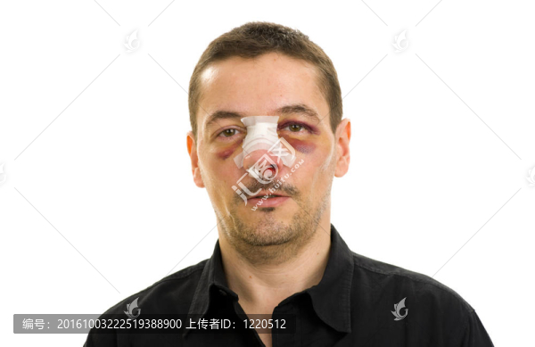 鼻子被打破