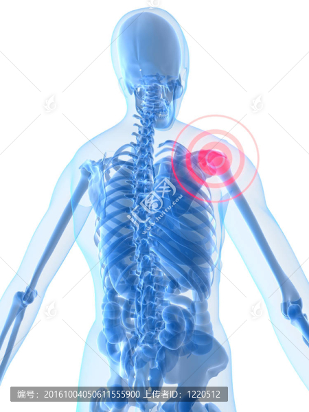 紅腫的肩膀-匯圖網(wǎng) www.fosd68.com 紅腫的肩膀