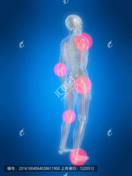 發(fā)炎的關(guān)節(jié)