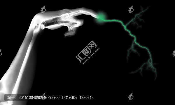電動骨架的手