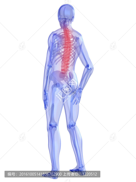 背痛的插圖