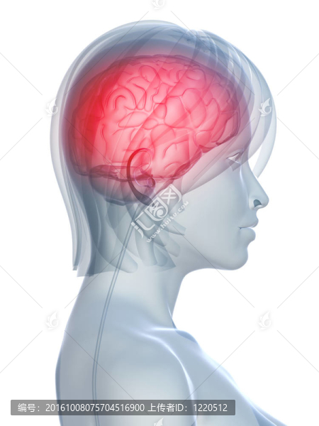 頭痛migraene
