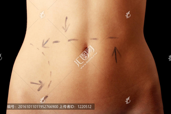 高加索婦女的腹部標(biāo)有線(xiàn)條