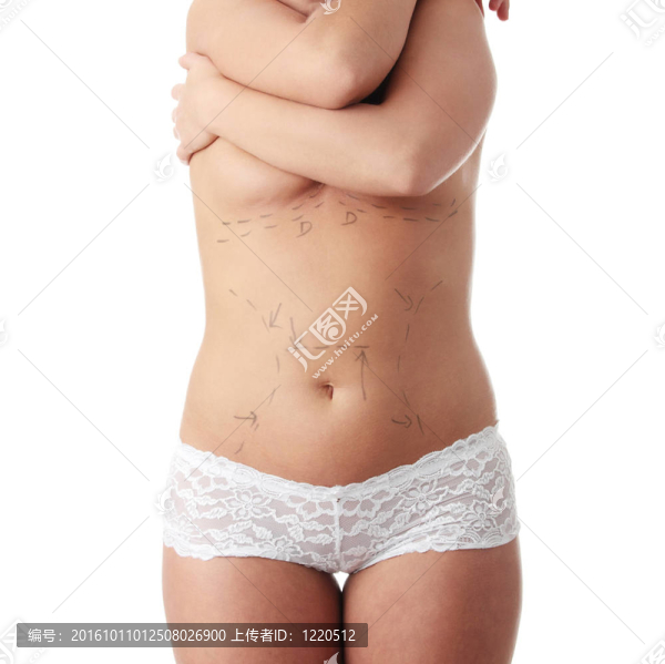 整容手術(shù)