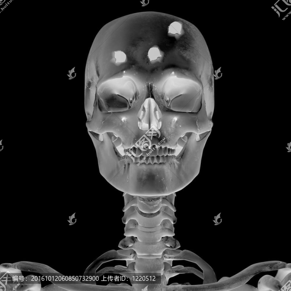顱腦損傷后3d影像
