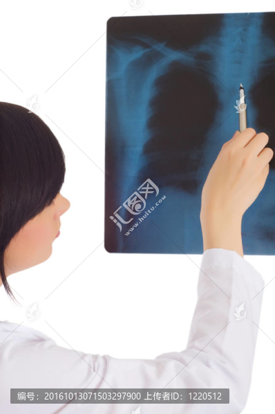 女醫(yī)生看白色X光圖像