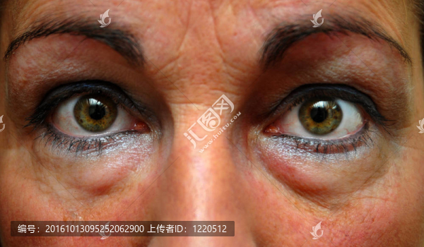 疲憊的女人眼睛的特寫(xiě)