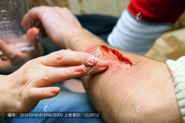 創(chuàng)建人工傷口