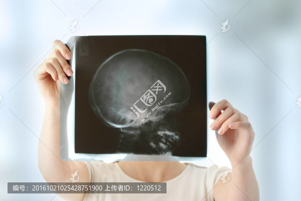 X光掃描