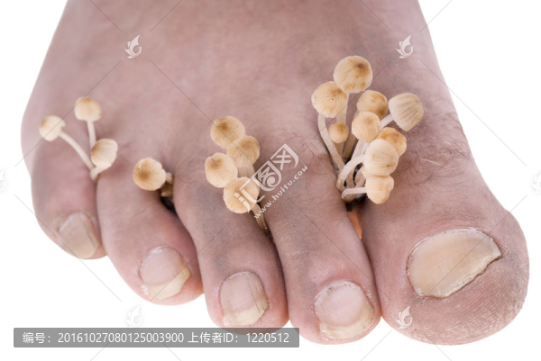 真菌病