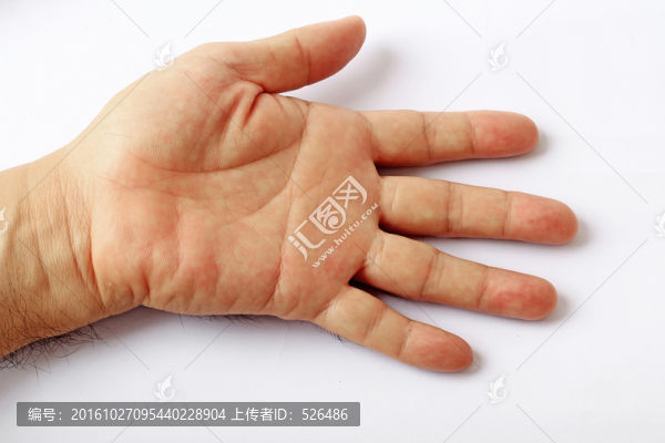 成人手掌