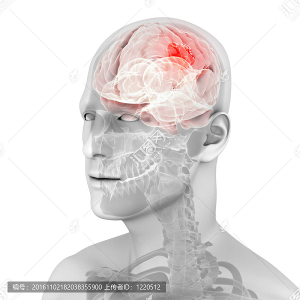 腦腫瘤