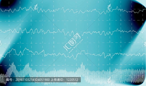 腦電腦電波
