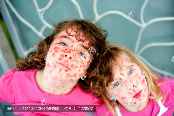 小女孩惡作劇偽裝口紅麻疹