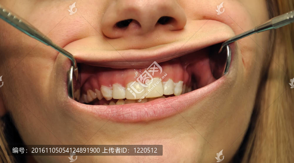 不整齊的牙齒